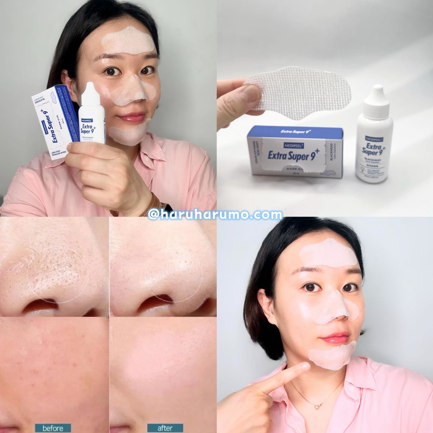 MEDIPEEL💙Extra Super 9+黑頭導出液✨