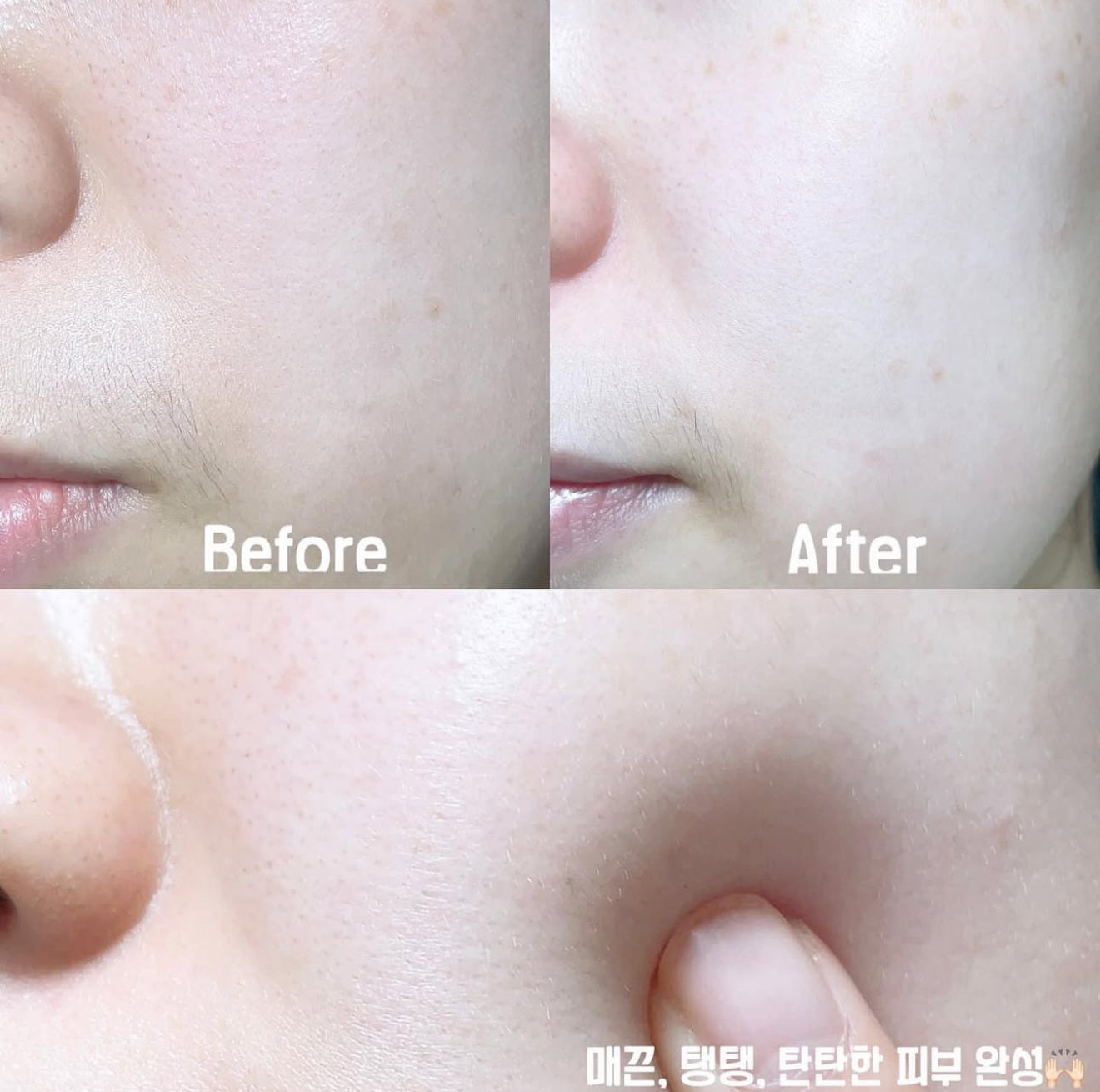 MEDIPEEL 🍎 膠原撕拉面膜✨