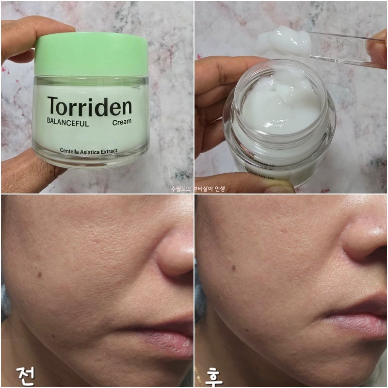 送10ml+10片棉片｜TORRIDEN 💚🧊五重積雪草密集舒緩爆水面霜
