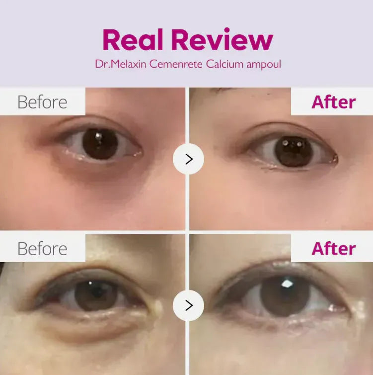👀Dr. Melaxin 極緻修護💫眼袋隱形霜 10ml