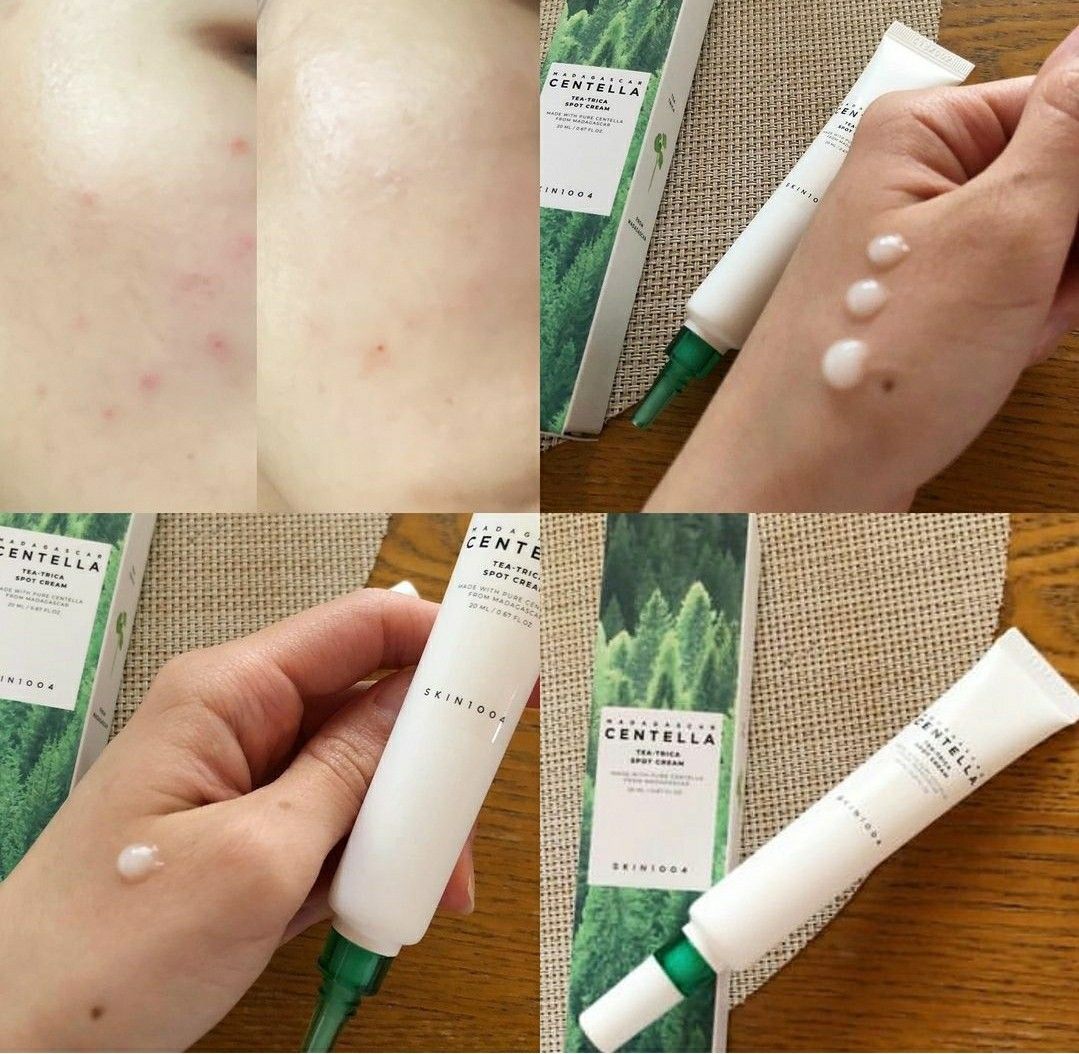 Skin1004 🌿 積雪草茶樹痘痘瑕疵護理霜✨